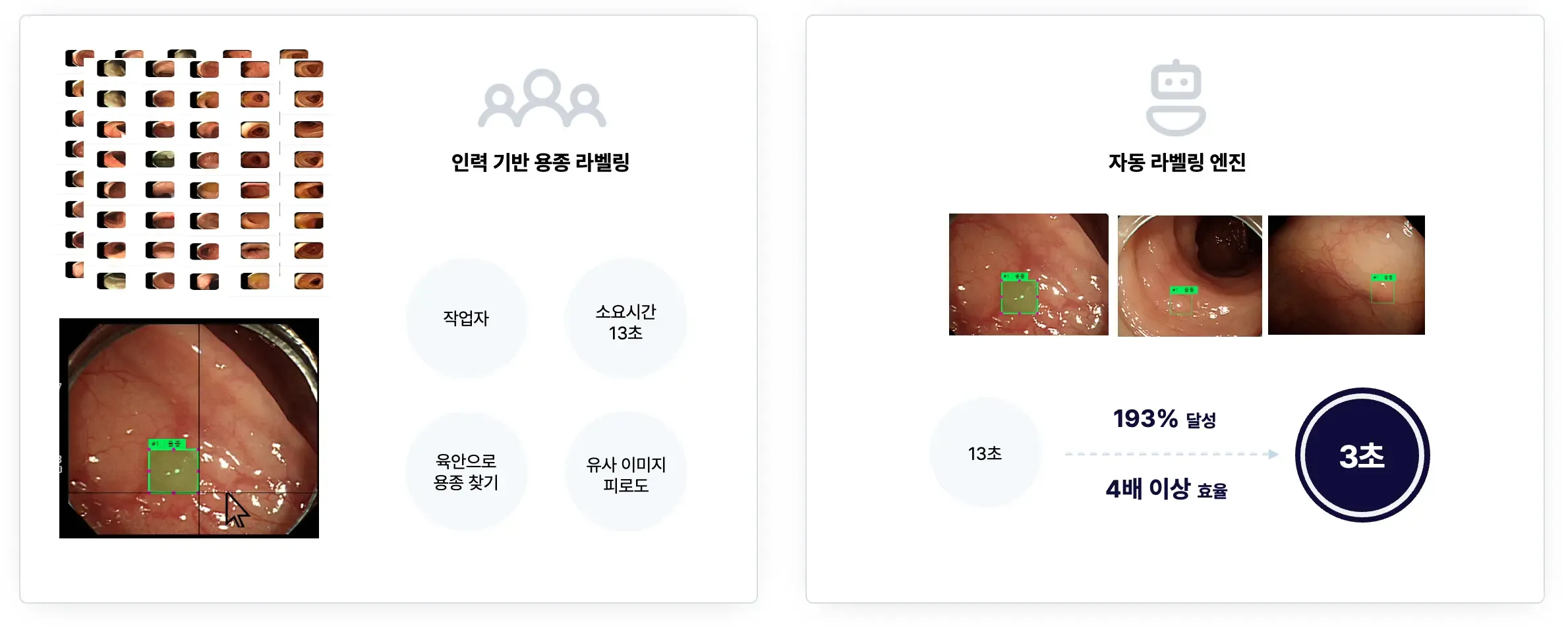 실시간 대장 용종 검출 AI 솔루션