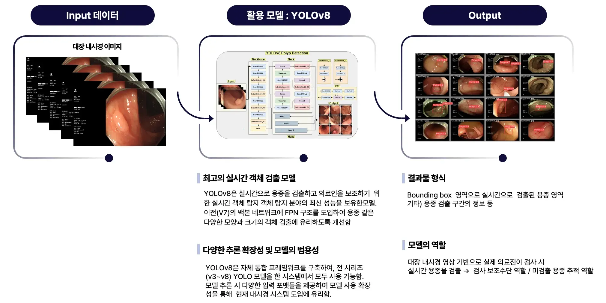 실시간 대장 용종 검출 AI 솔루션