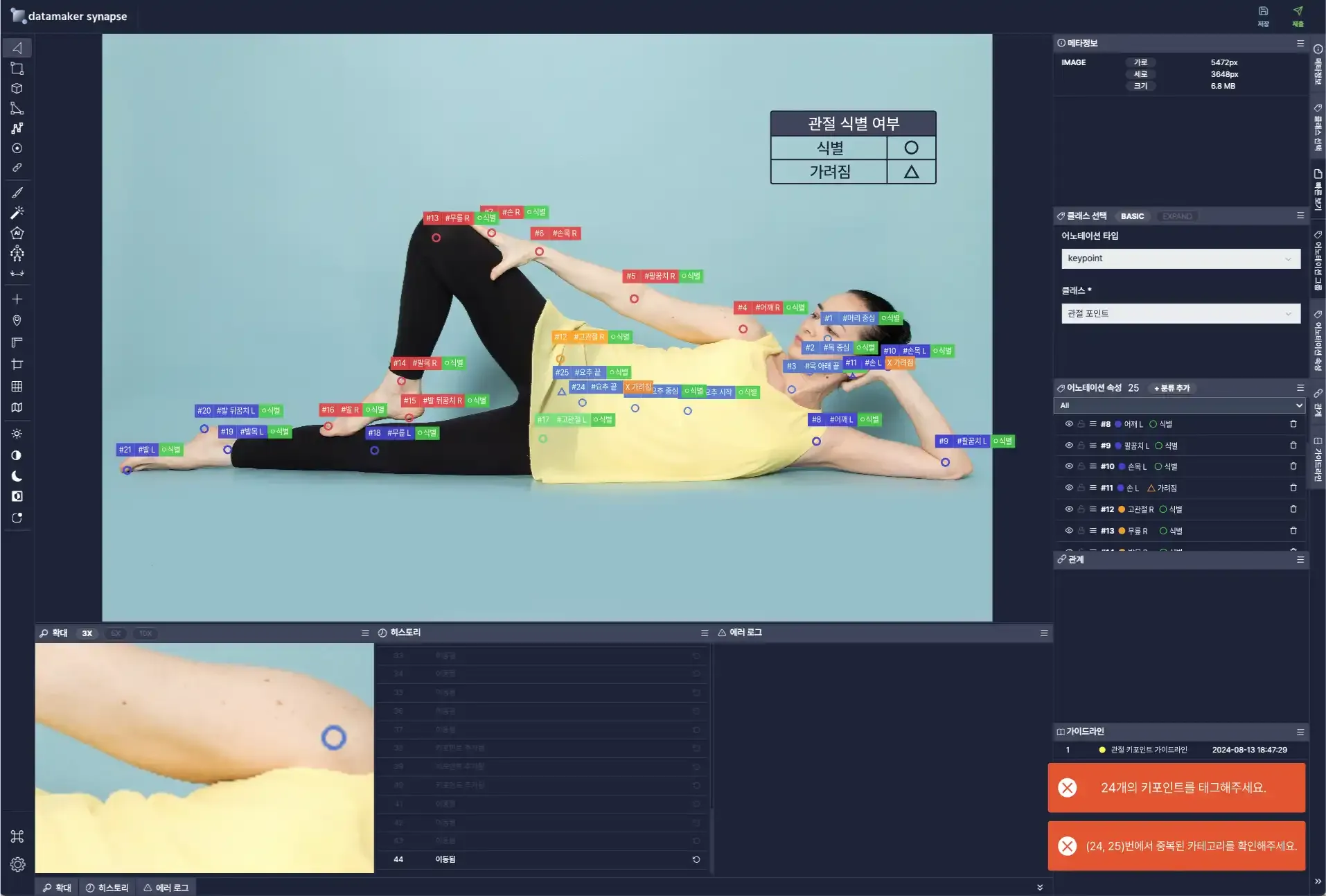 근골격계 질환 디지털 치료