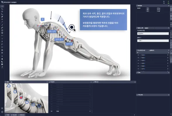 근골격계 질환 디지털 치료